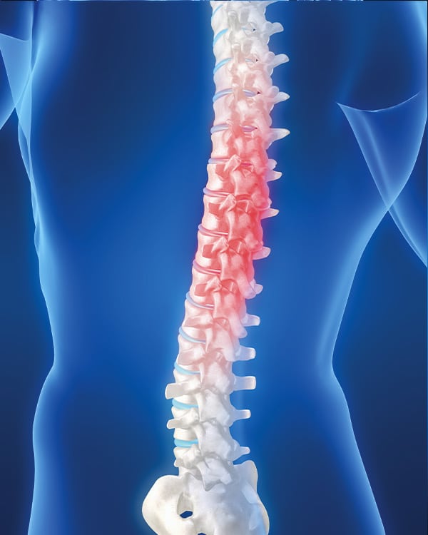 Scoliosis_Chiropractic_Treatment
